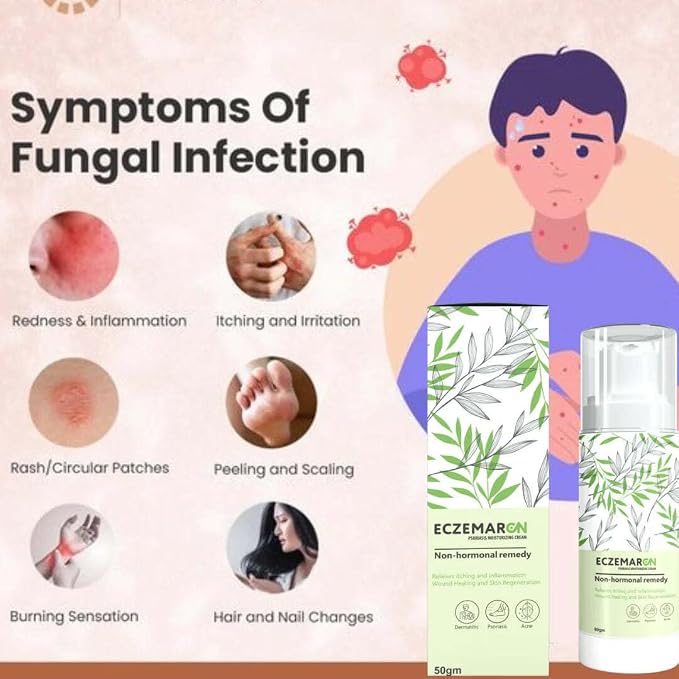 Fungal Cream For Men & Women - TruVexa