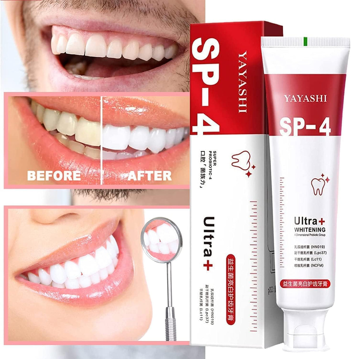 Sp-4 probiotic whitening toothpaste, Teeth Whitener Toothpaste, Natural Tooth Whitener - TruVexa